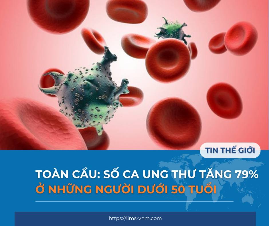 so ca ung thu tang o nhung nguoi duoi 59 tuoi.jpg