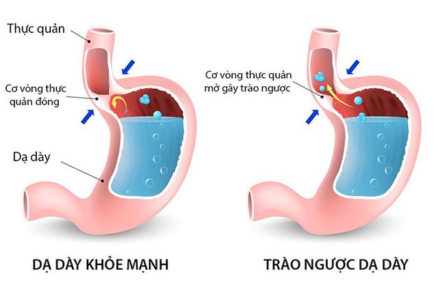 165959trao-nguoc-da-day.jpg