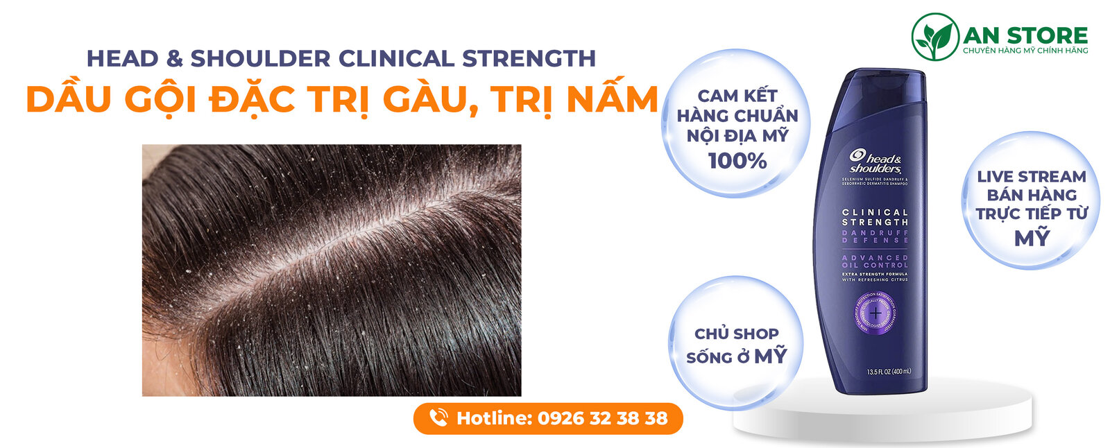 Dầu Gội Đặc Trị Gàu Của Mỹ.jpg