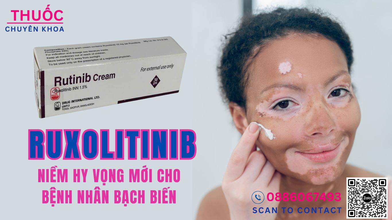 Bệnh Bạch Biến.jpg Bệnh Bạch Biến.jpg