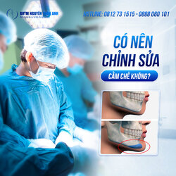 Có nên chỉnh sửa Cằm chẻ không.jpg