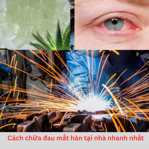 cach-chua-dau-mat-han-tai-nha.jpg