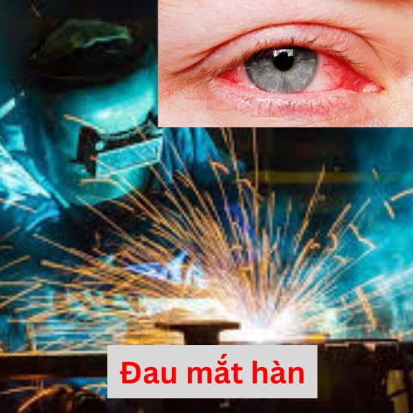 dau-mat-han.jpg