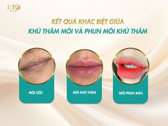 Khu-tham-moi-4.jpg