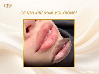 Khu-tham-moi-co-bi-tham-lai-khong-4.jpg