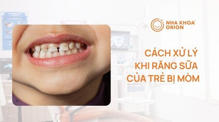 cach-xu-ly-khi-rang-sua-cua-tre-bi-mon.jpg