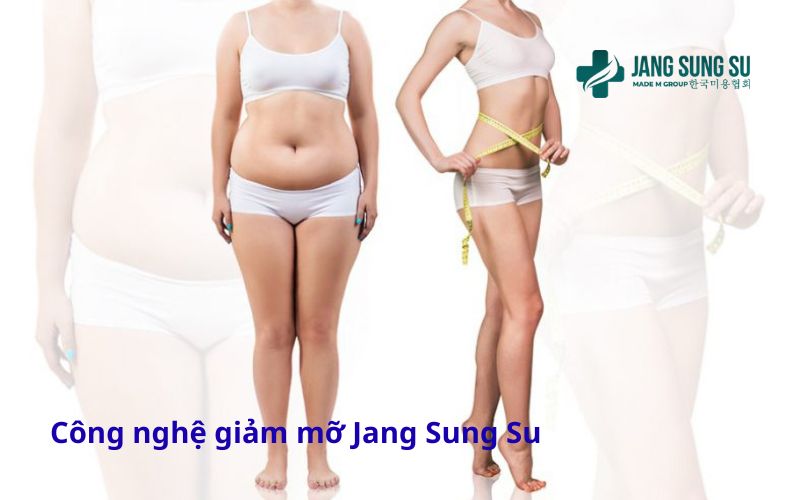 cong-nghe-giam-mo-jang-sung-su.jpg