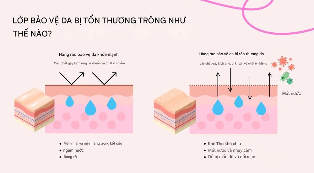 hàng rào bảo vệ da.jpg