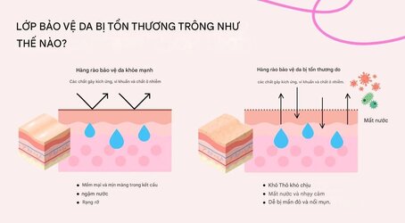 hàng rào bảo vệ da.jpg