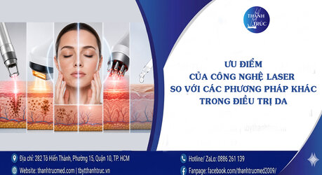 Uu-diem-cua-cong-nghe-laser.jpg