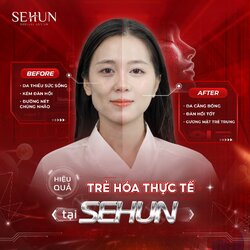 tre-hoa-sehun.jpg