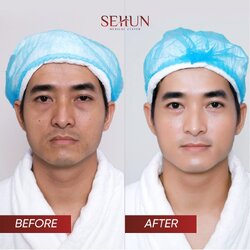 tre-hoa-lan-da-tham-my-sehun.jpg