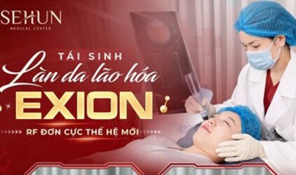 tham-my-sehun-bi-phat-con-hoat-dong-khong.jpg