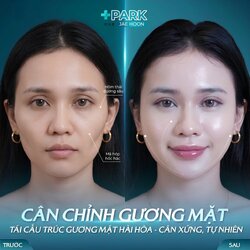 mat-lom-hop-co-dung-ai-face-jp-duoc-khong-1024x1024.jpg
